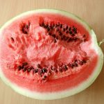 팔뚝살 시술 비용과 주기 알아보자